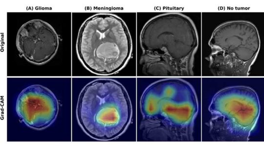 A photo showing eight brain scans. The rop row of scans is black and white and the second row is in color.