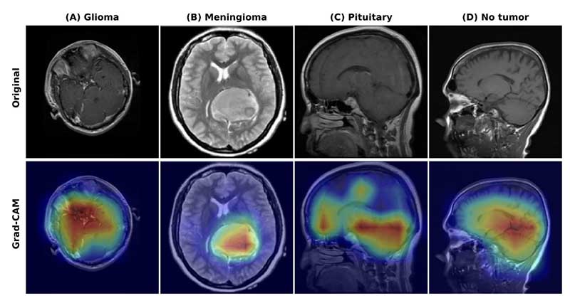 A photo showing eight brain scans. The rop row of scans is black and white and the second row is in color.